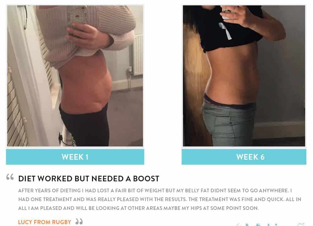 Before and After Dieting Henley-In-Arden