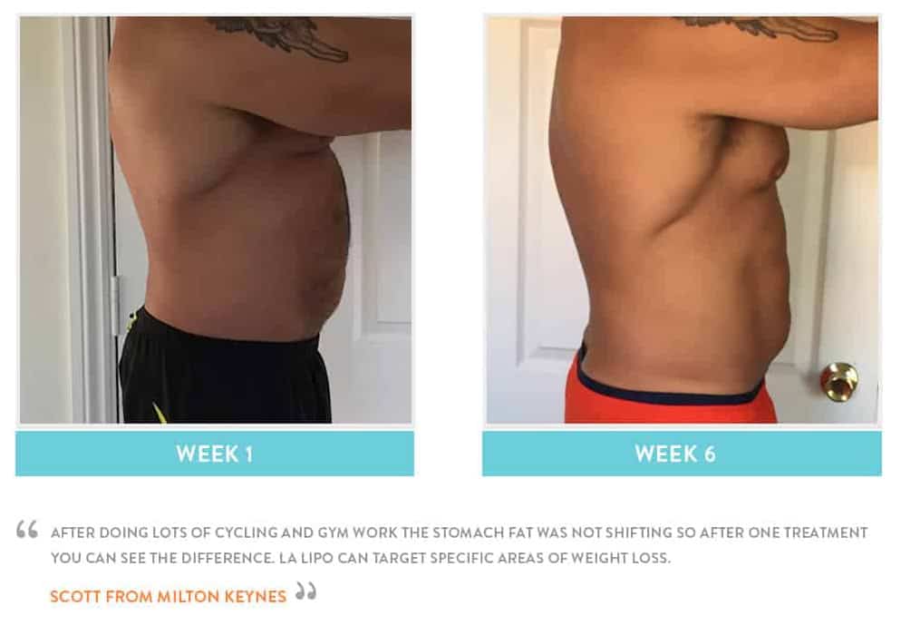 Before & After Stomach Fat Henley-In-Arden