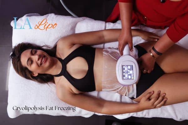 woman getting cryolipolysis Henley-In-Arden