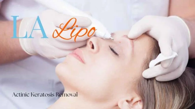 Woman receiving Actinic Keratosis Removal Treatment Henley-In-Arden
