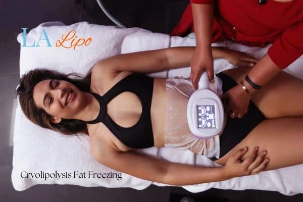 woman getting cryolipolysis Henley-In-Arden