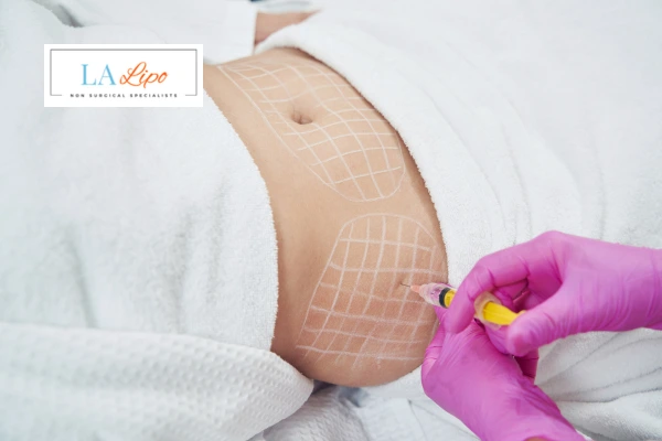 aqualyx fat dissolving injections Henley-In-Arden
