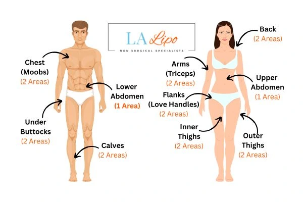 LA LIPO Cryolipolysis Areas Henley-In-Arden