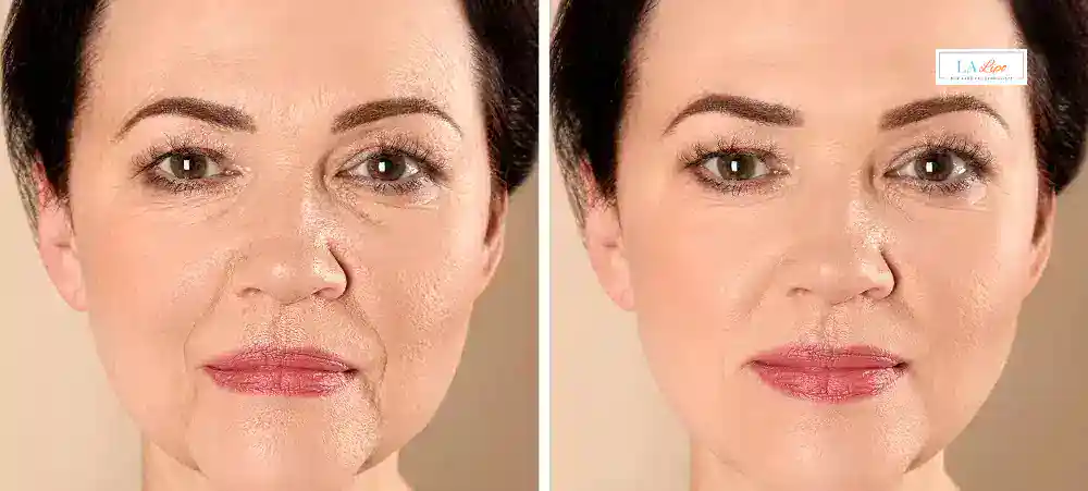 Why Aren’t My Skincare Products Making My Sagging Skin Look Firmer Henley-In-Arden?