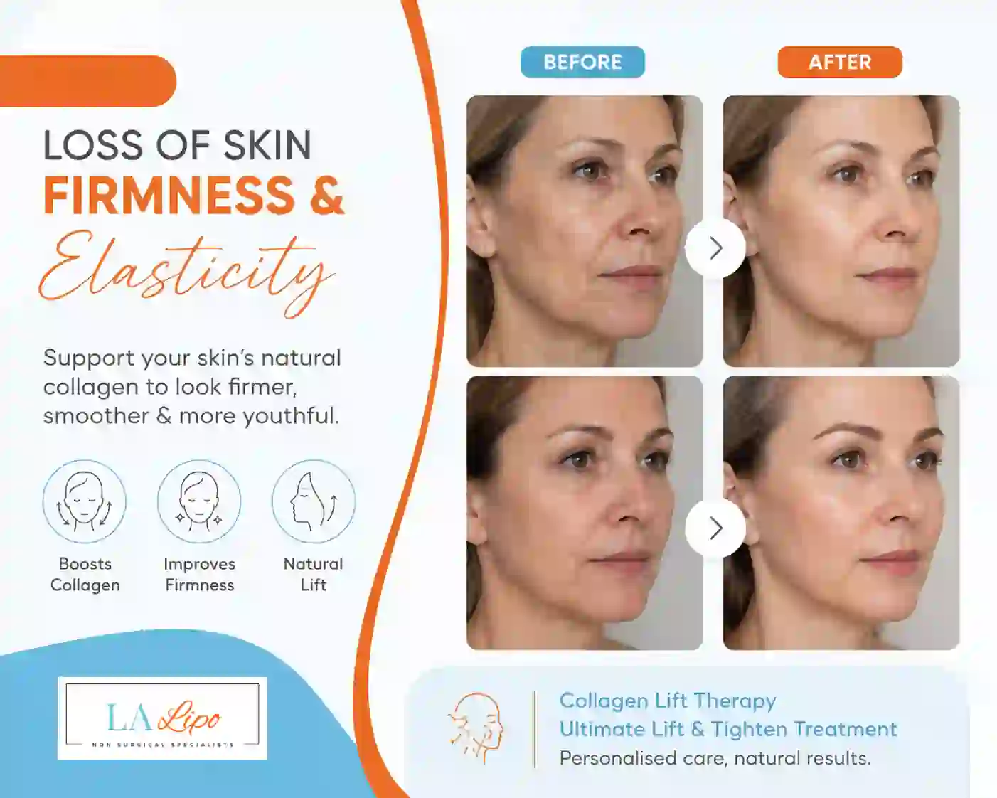 Sign #7: Loss of Skin Firmness and Elasticity Henley-In-Arden